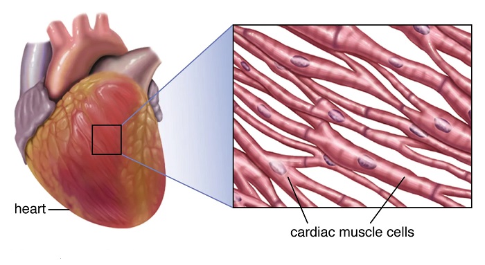 زیر عضله قلب چیست و چه علائمی دارد