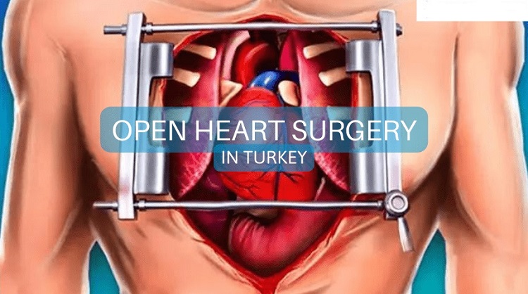 نکات مهم هنگام جراحی عمل قلب باز کدامند